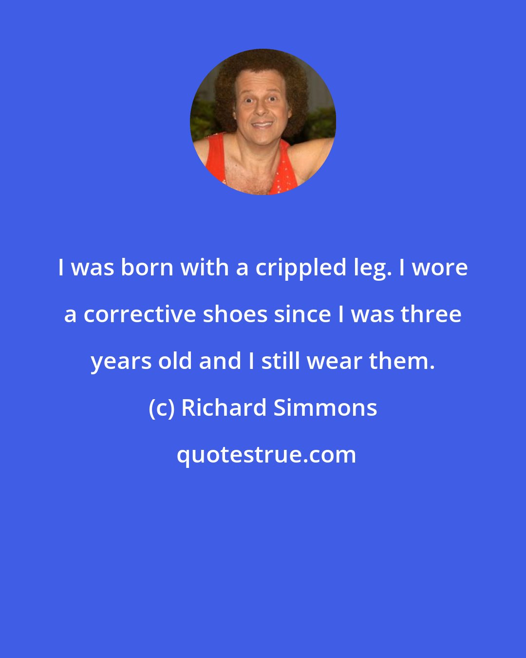 Richard Simmons: I was born with a crippled leg. I wore a corrective shoes since I was three years old and I still wear them.