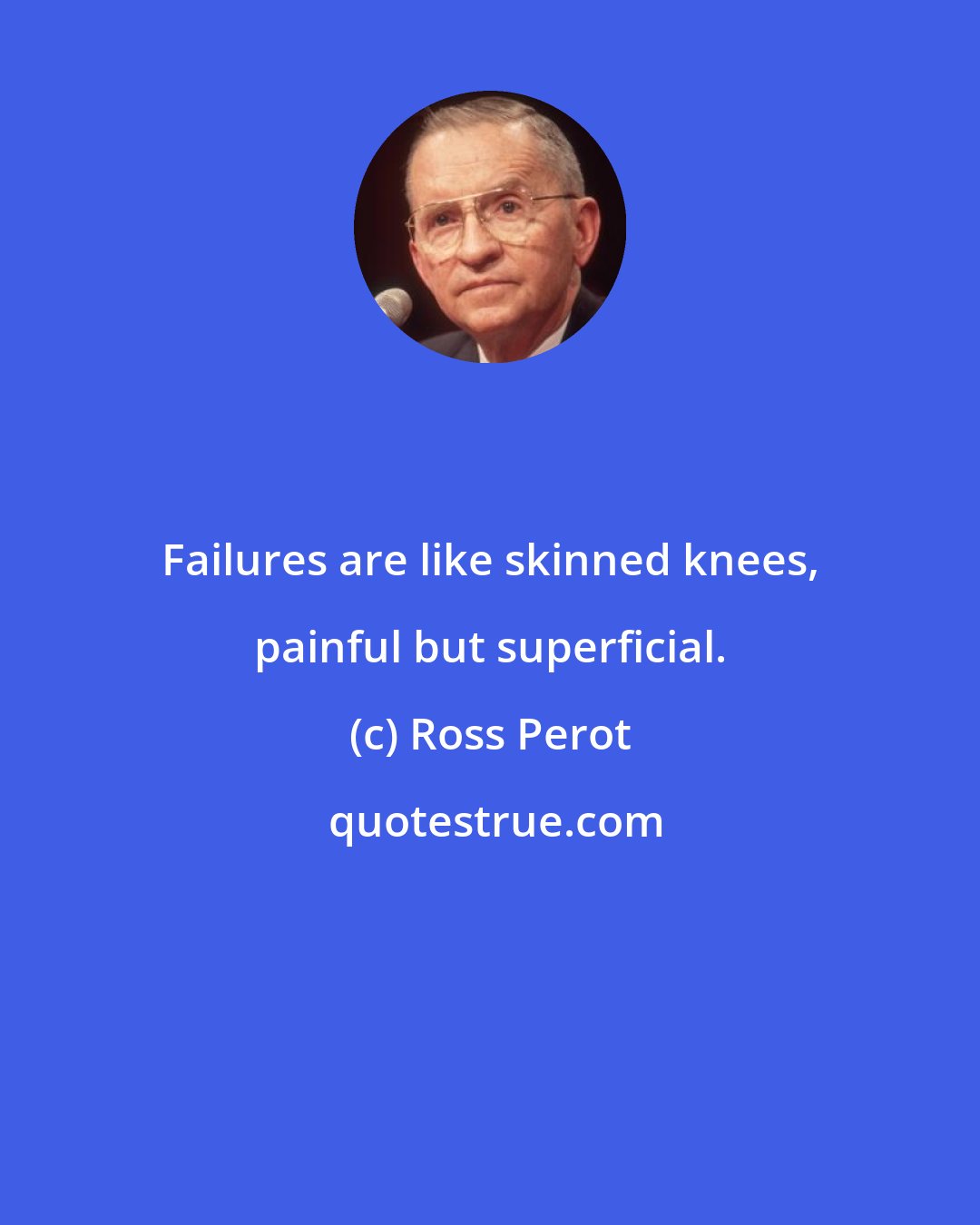 Ross Perot: Failures are like skinned knees, painful but superficial.