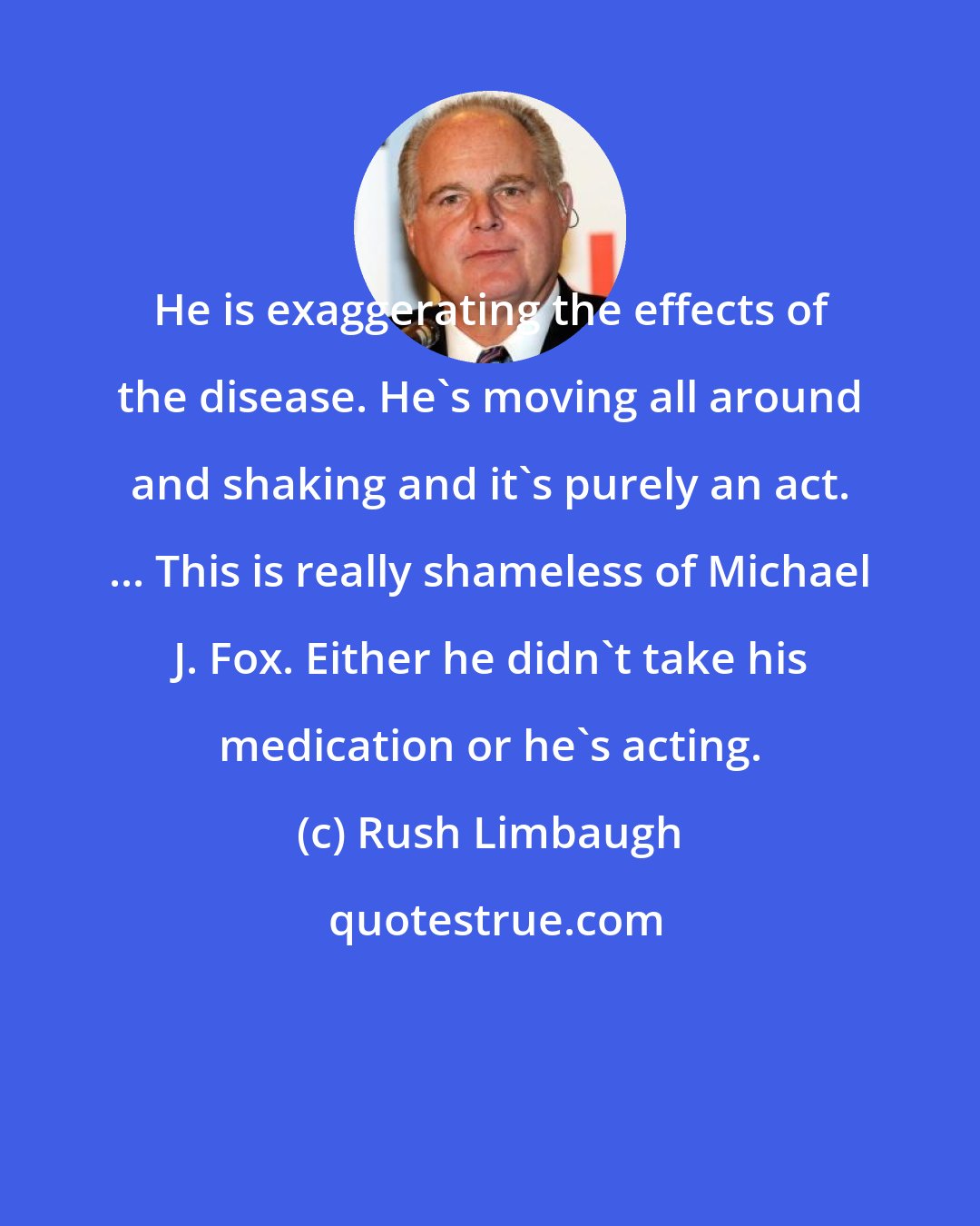Rush Limbaugh: He is exaggerating the effects of the disease. He's moving all around and shaking and it's purely an act. ... This is really shameless of Michael J. Fox. Either he didn't take his medication or he's acting.