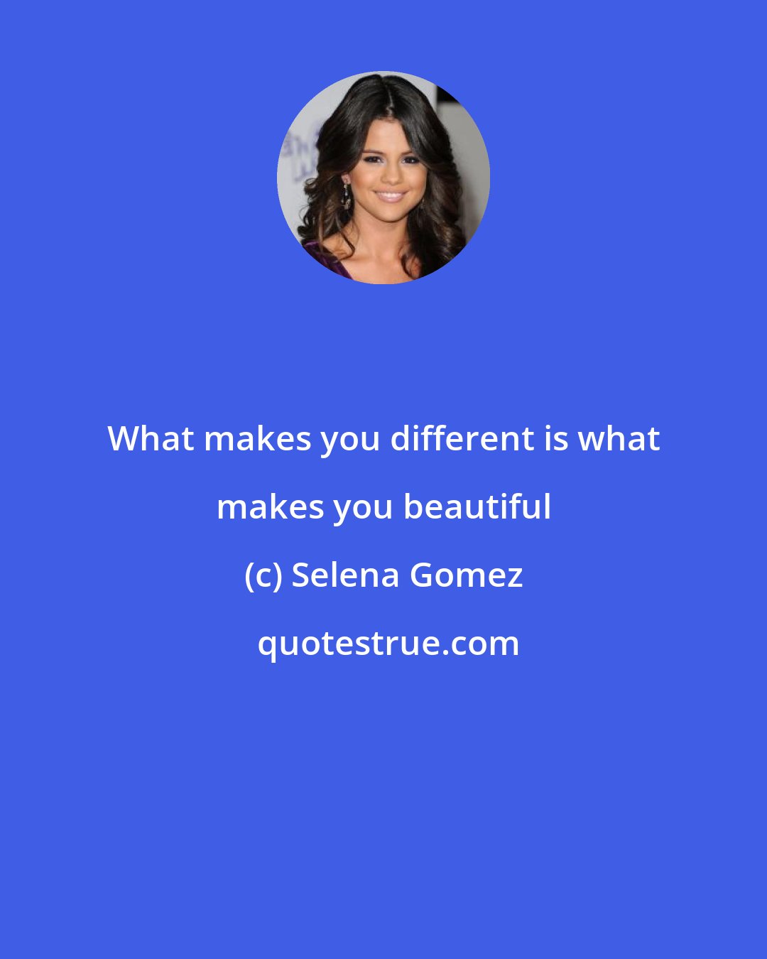 Selena Gomez: What makes you different is what makes you beautiful