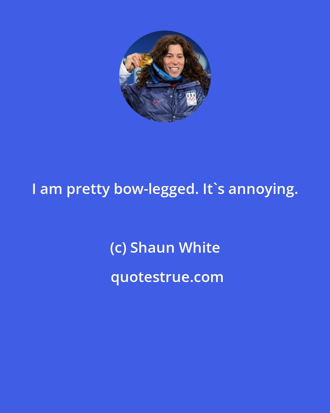 Shaun White: I am pretty bow-legged. It's annoying.