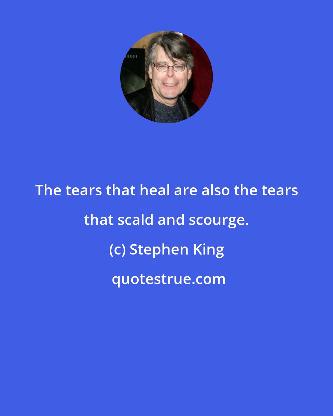 Stephen King: The tears that heal are also the tears that scald and scourge.