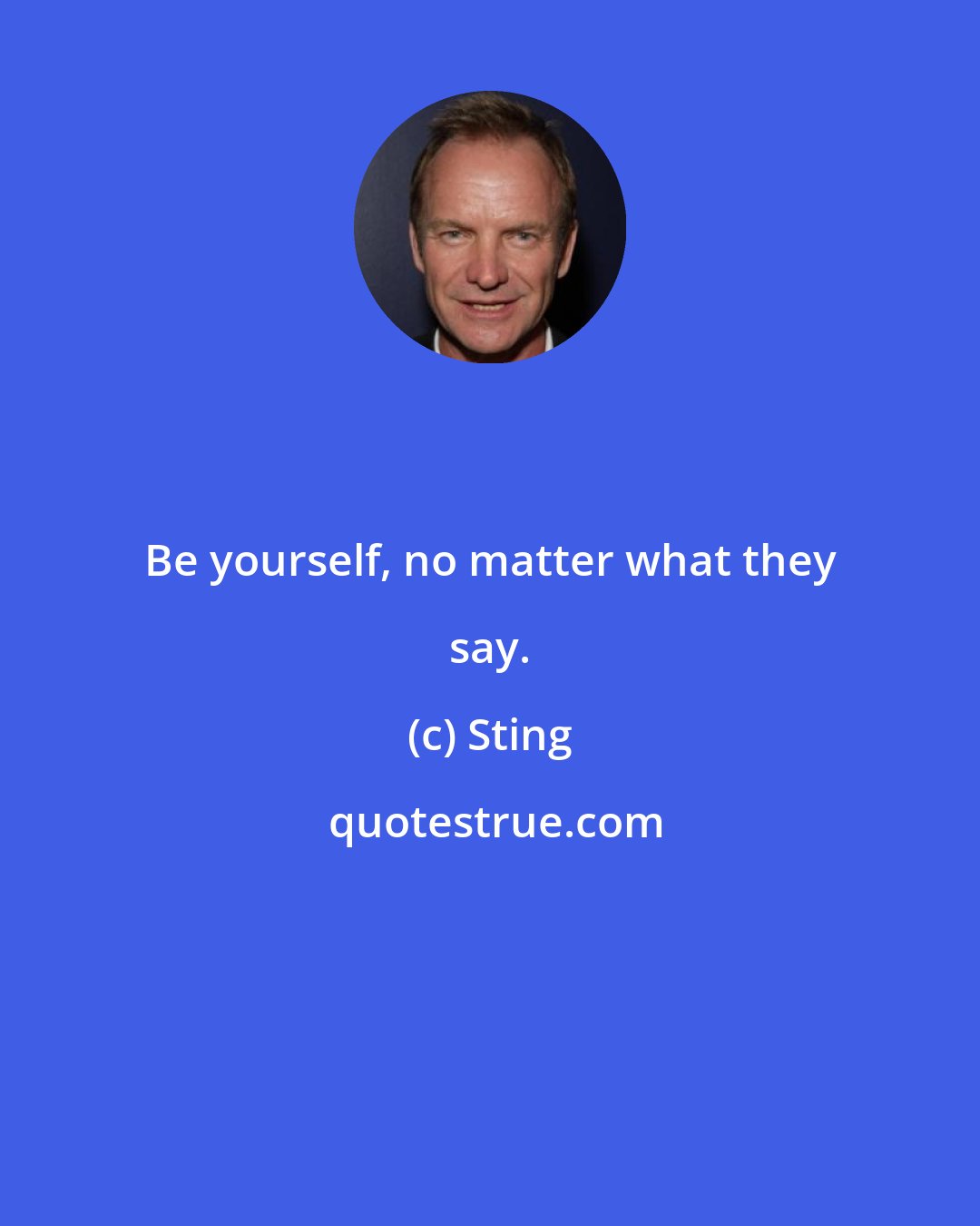 Sting: Be yourself, no matter what they say.
