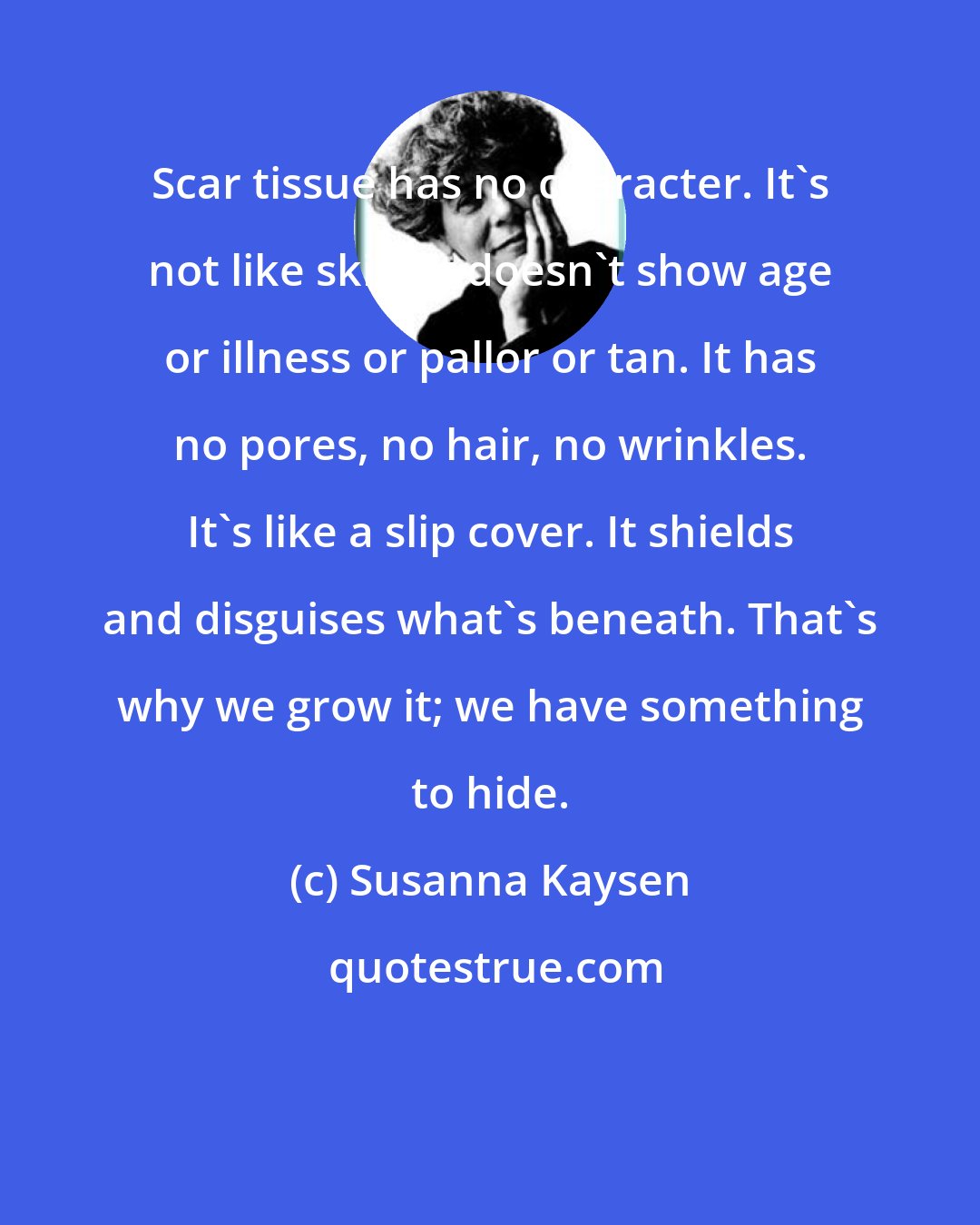 Susanna Kaysen: Scar tissue has no character. It's not like skin. It doesn't show age or illness or pallor or tan. It has no pores, no hair, no wrinkles. It's like a slip cover. It shields and disguises what's beneath. That's why we grow it; we have something to hide.