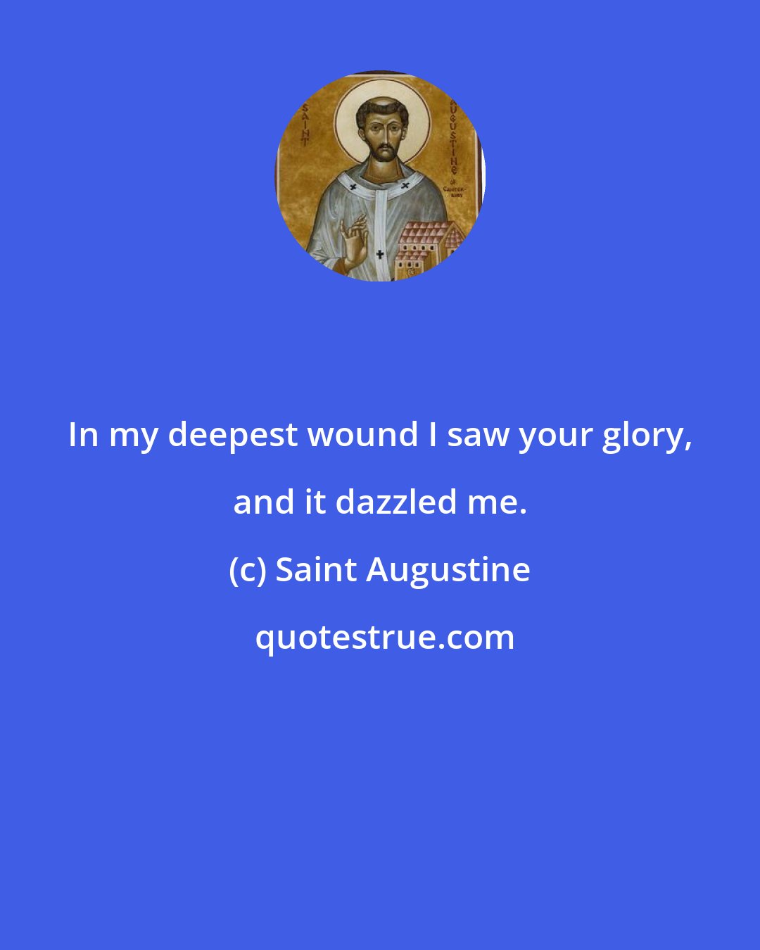 Saint Augustine: In my deepest wound I saw your glory, and it dazzled me.