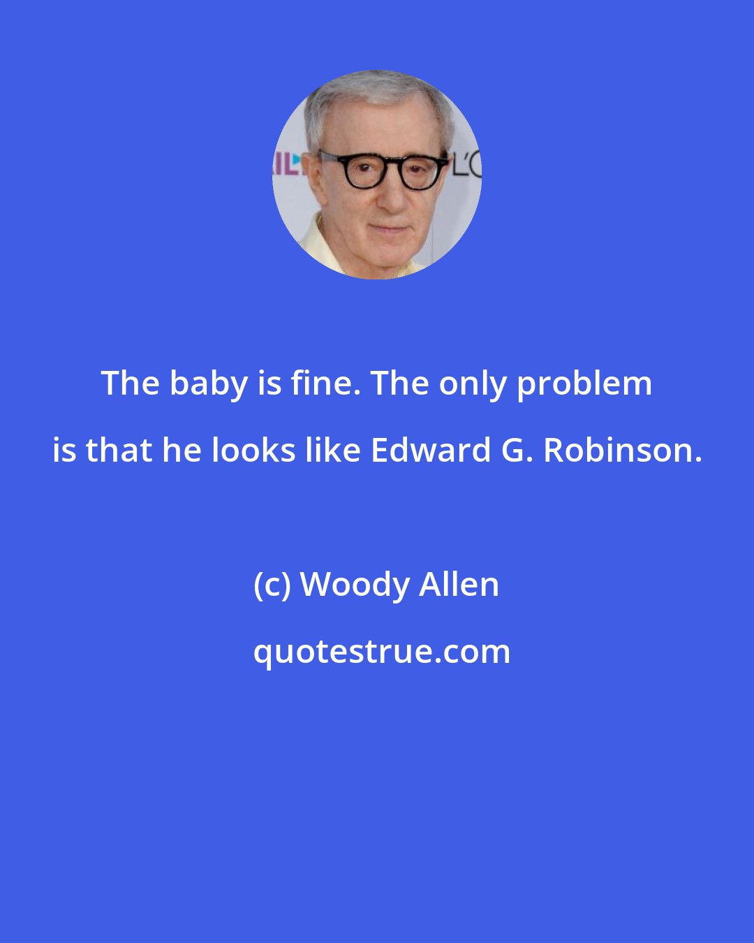 Woody Allen: The baby is fine. The only problem is that he looks like Edward G. Robinson.