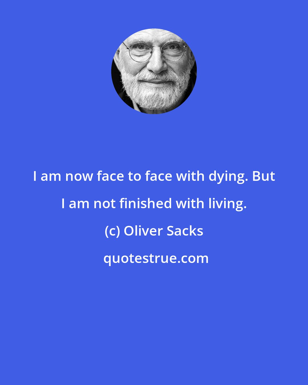 Oliver Sacks: I am now face to face with dying. But I am not finished with living.