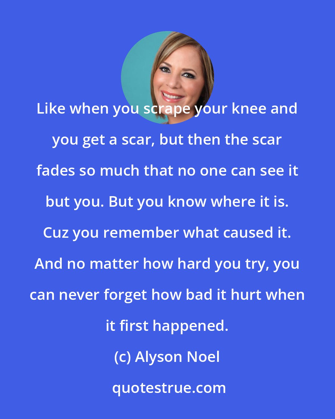 Alyson Noel: Like when you scrape your knee and you get a scar, but then the scar fades so much that no one can see it but you. But you know where it is. Cuz you remember what caused it. And no matter how hard you try, you can never forget how bad it hurt when it first happened.