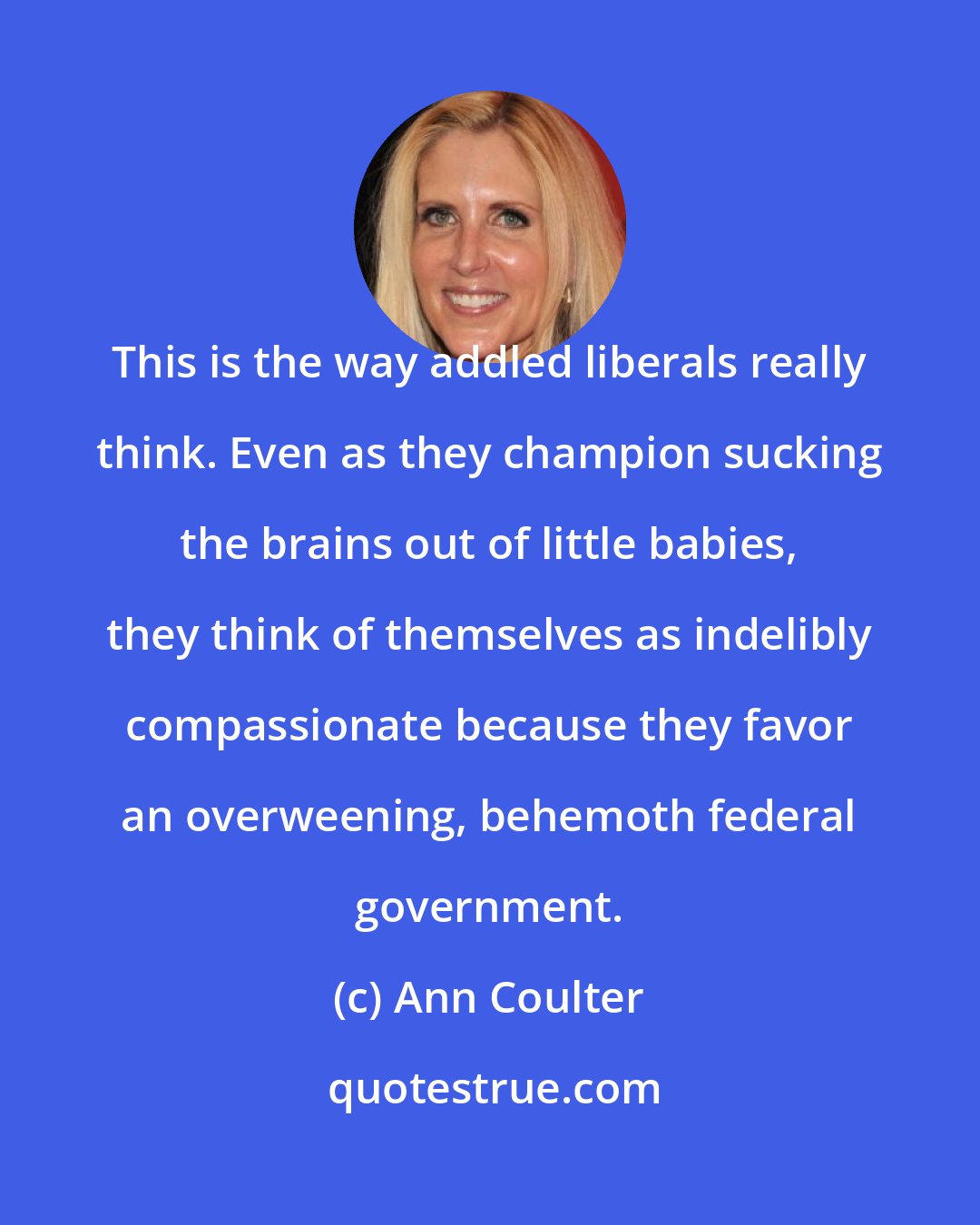 Ann Coulter: This is the way addled liberals really think. Even as they champion sucking the brains out of little babies, they think of themselves as indelibly compassionate because they favor an overweening, behemoth federal government.