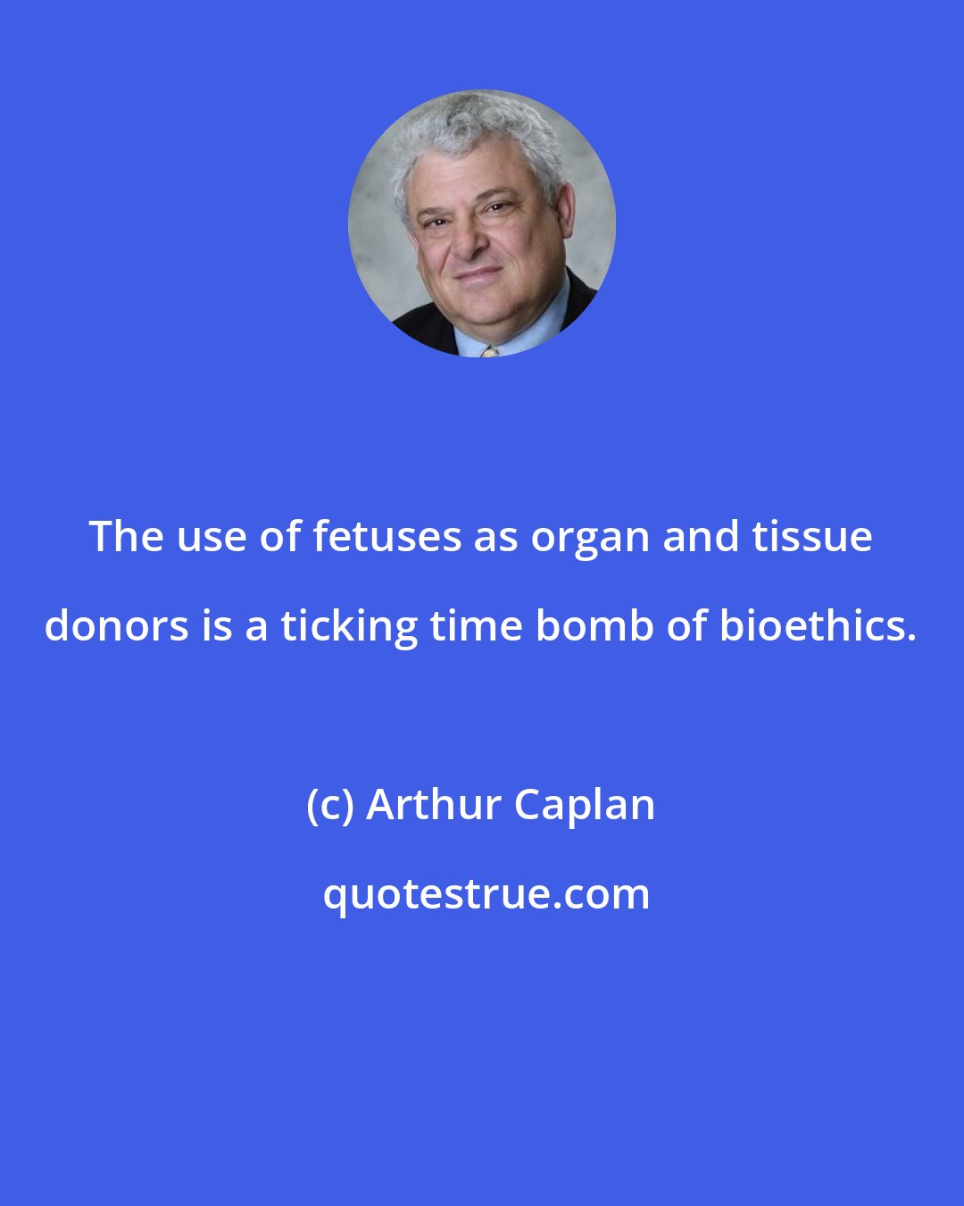 Arthur Caplan: The use of fetuses as organ and tissue donors is a ticking time bomb of bioethics.