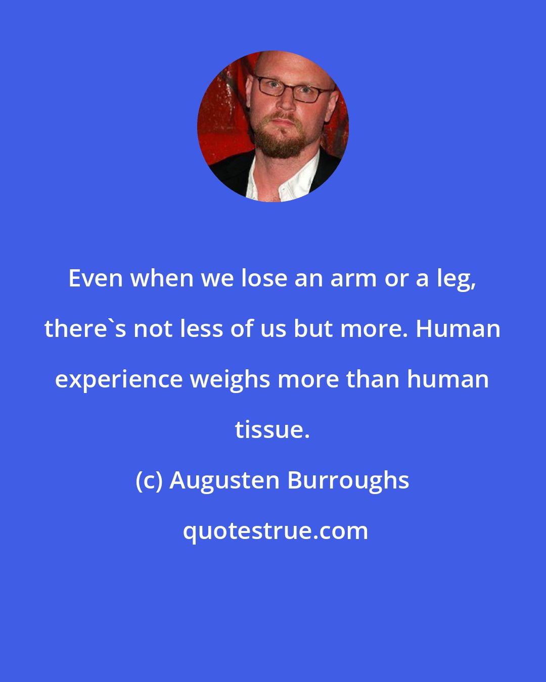 Augusten Burroughs: Even when we lose an arm or a leg, there's not less of us but more. Human experience weighs more than human tissue.