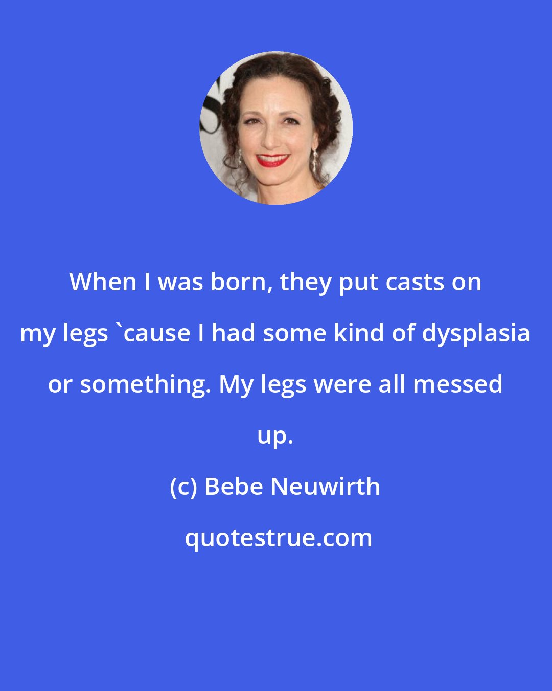 Bebe Neuwirth: When I was born, they put casts on my legs 'cause I had some kind of dysplasia or something. My legs were all messed up.