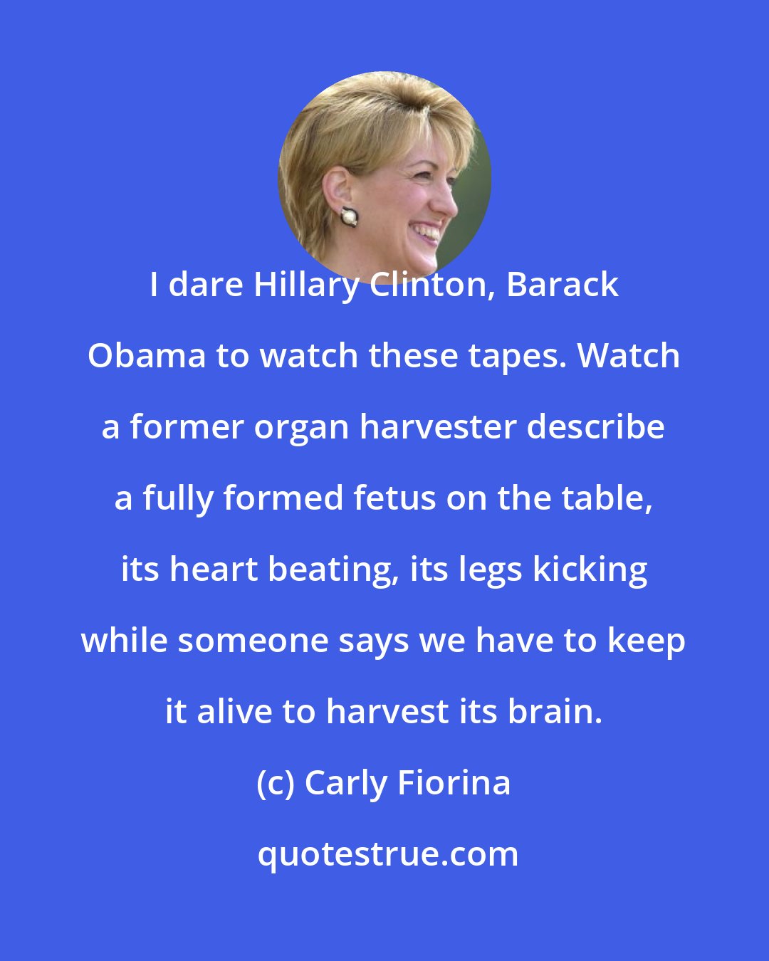 Carly Fiorina: I dare Hillary Clinton, Barack Obama to watch these tapes. Watch a former organ harvester describe a fully formed fetus on the table, its heart beating, its legs kicking while someone says we have to keep it alive to harvest its brain.