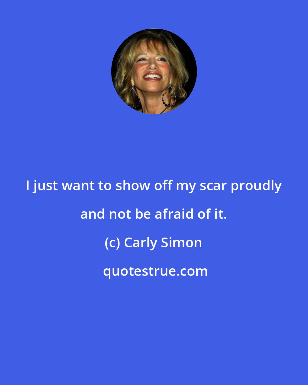 Carly Simon: I just want to show off my scar proudly and not be afraid of it.