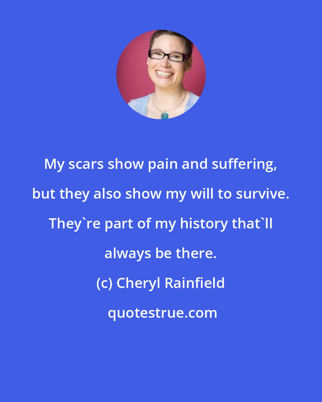 Cheryl Rainfield: My scars show pain and suffering, but they also show my will to survive. They're part of my history that'll always be there.