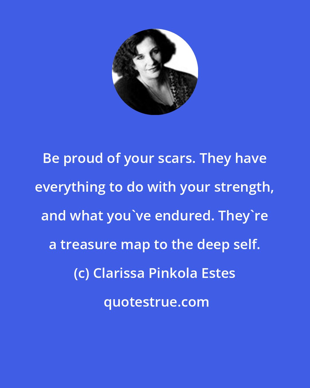 Clarissa Pinkola Estes: Be proud of your scars. They have everything to do with your strength, and what you've endured. They're a treasure map to the deep self.