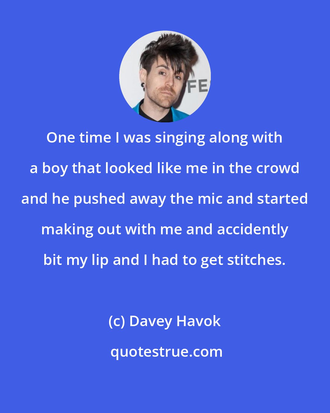 Davey Havok: One time I was singing along with a boy that looked like me in the crowd and he pushed away the mic and started making out with me and accidently bit my lip and I had to get stitches.