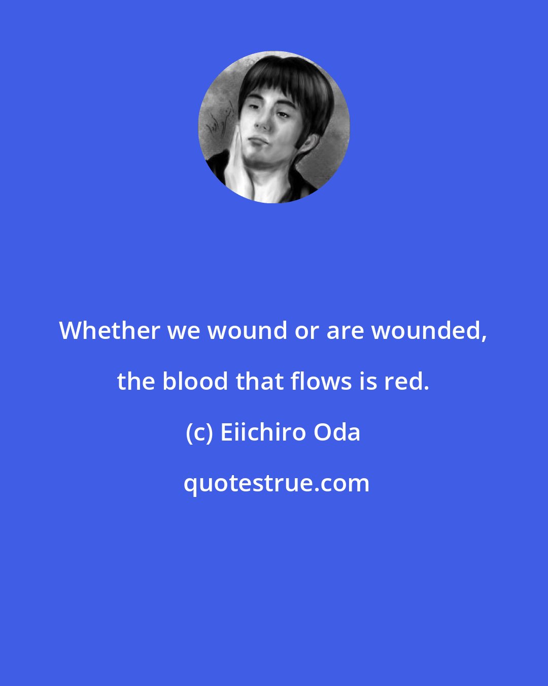 Eiichiro Oda: Whether we wound or are wounded, the blood that flows is red.