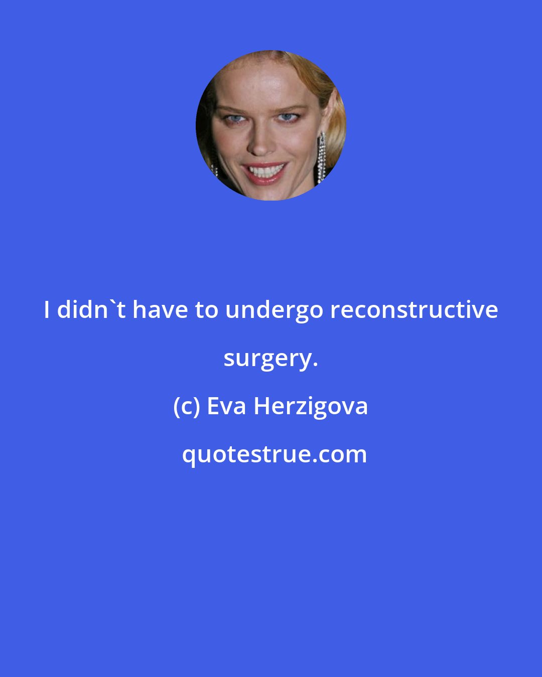 Eva Herzigova: I didn't have to undergo reconstructive surgery.