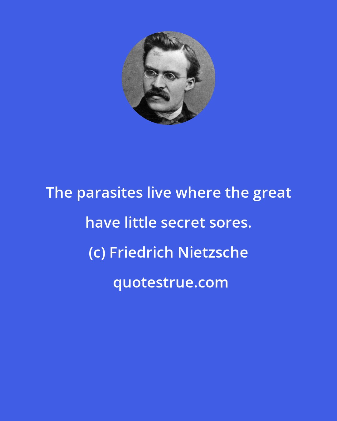 Friedrich Nietzsche: The parasites live where the great have little secret sores.