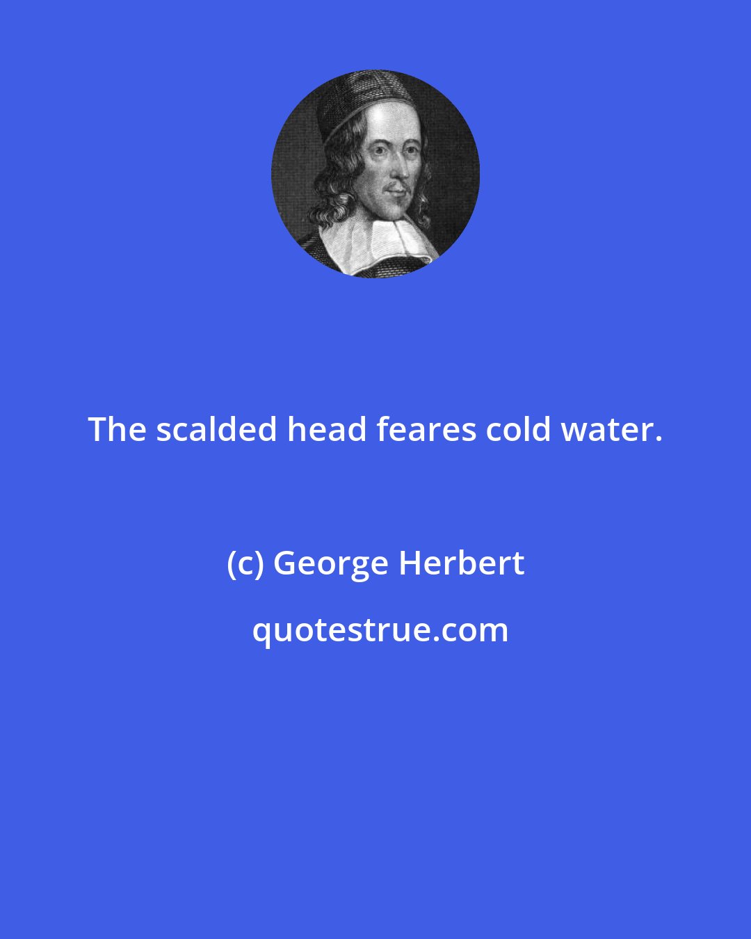 George Herbert: The scalded head feares cold water.