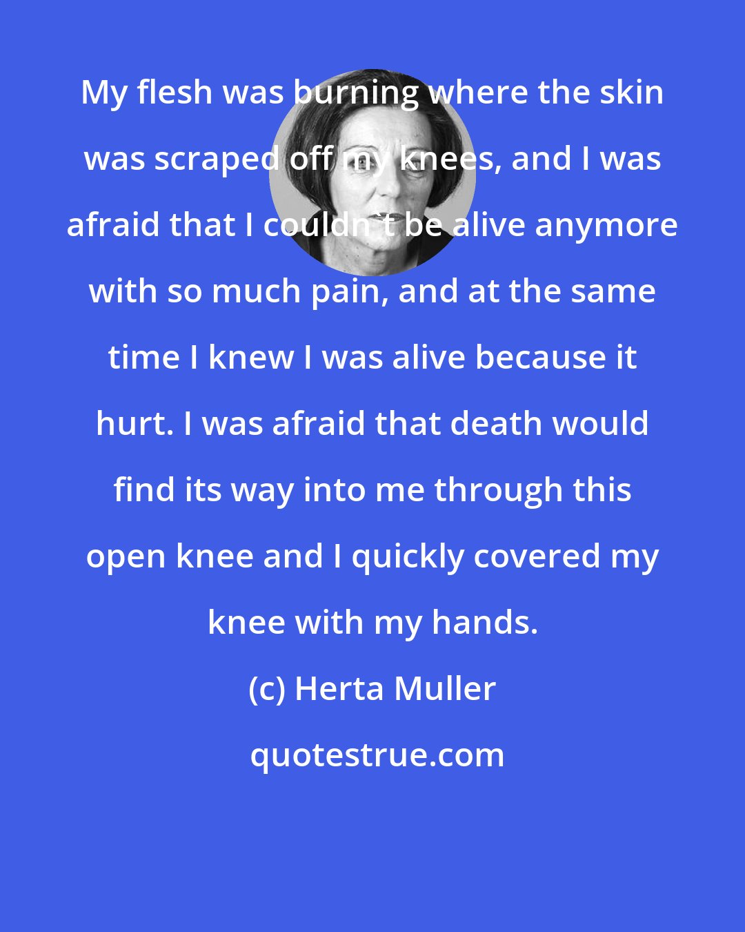 Herta Muller: My flesh was burning where the skin was scraped off my knees, and I was afraid that I couldn't be alive anymore with so much pain, and at the same time I knew I was alive because it hurt. I was afraid that death would find its way into me through this open knee and I quickly covered my knee with my hands.
