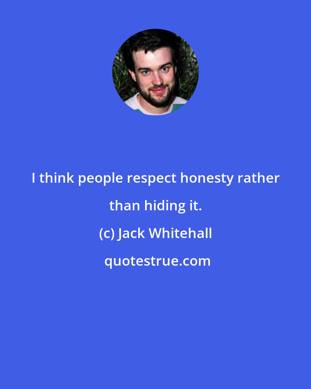 Jack Whitehall: I think people respect honesty rather than hiding it.