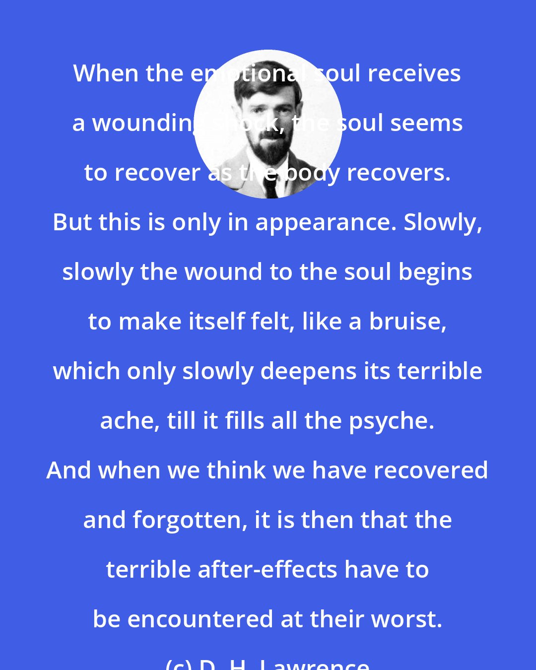 D. H. Lawrence: When the emotional soul receives a wounding shock, the soul seems to recover as the body recovers. But this is only in appearance. Slowly, slowly the wound to the soul begins to make itself felt, like a bruise, which only slowly deepens its terrible ache, till it fills all the psyche. And when we think we have recovered and forgotten, it is then that the terrible after-effects have to be encountered at their worst.