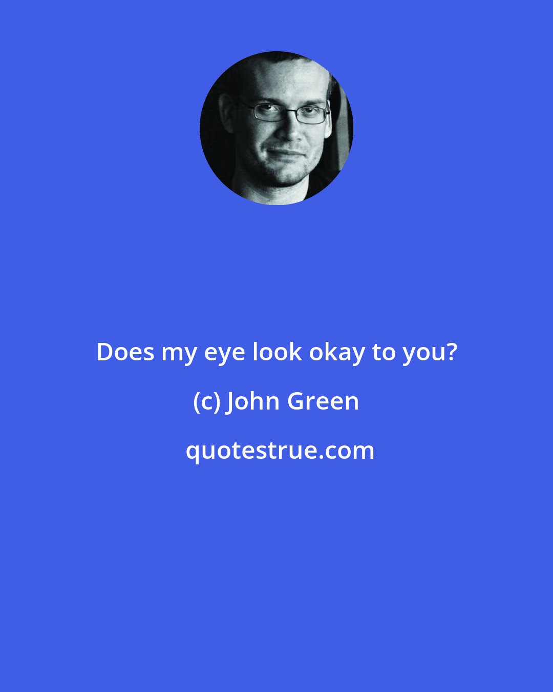 John Green: Does my eye look okay to you?