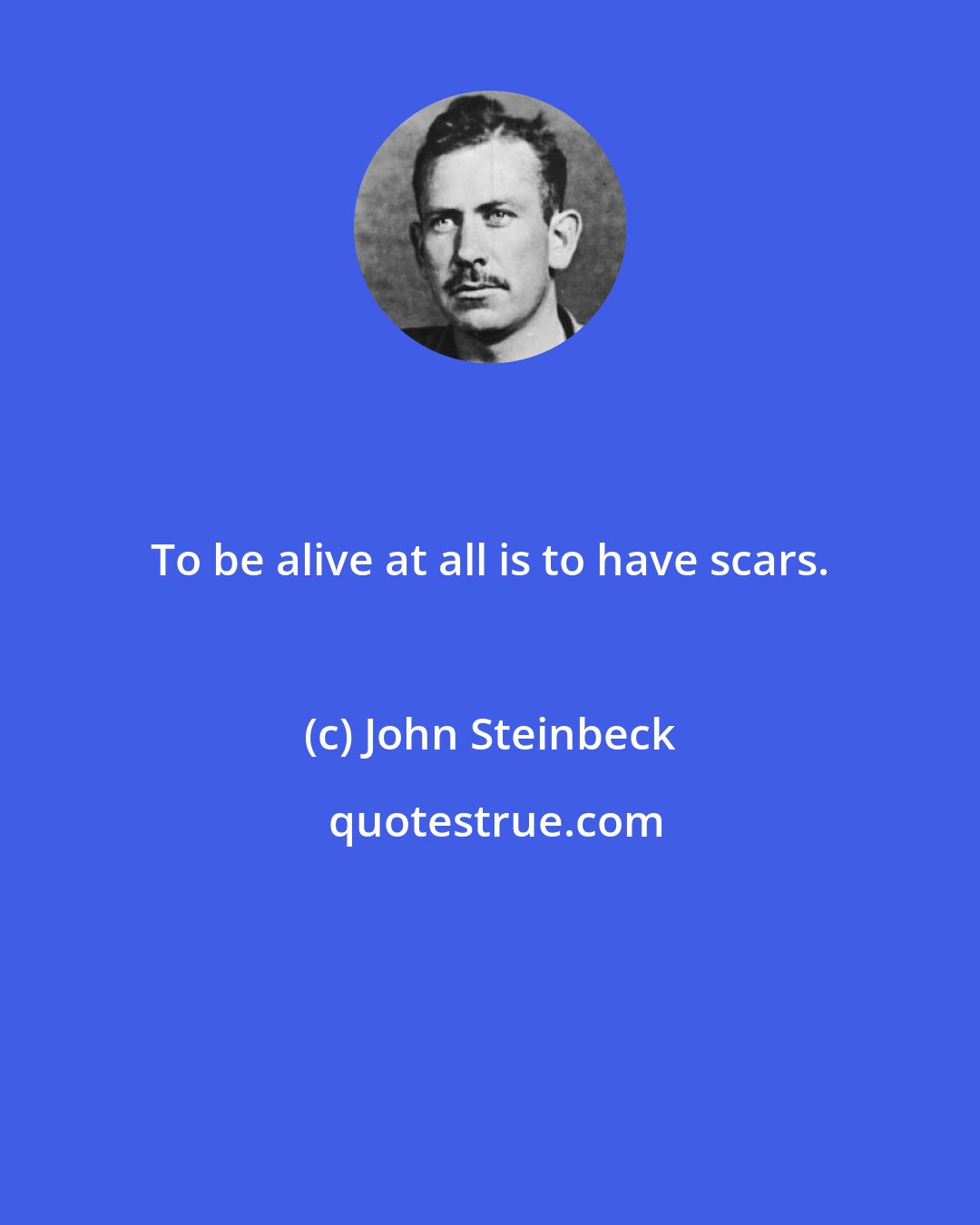 John Steinbeck: To be alive at all is to have scars.