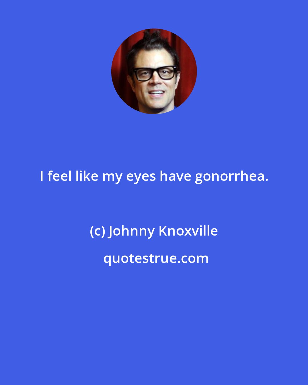Johnny Knoxville: I feel like my eyes have gonorrhea.