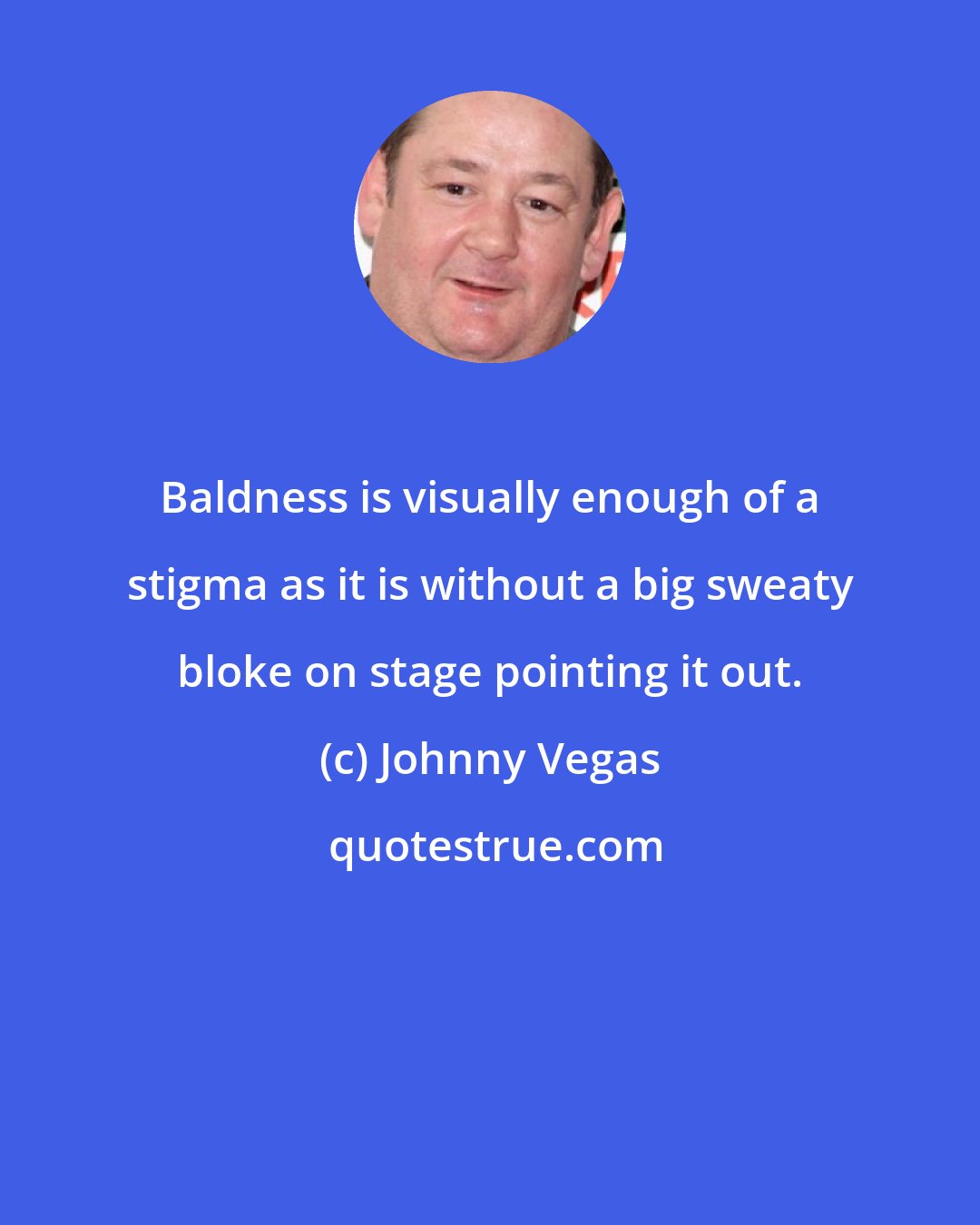 Johnny Vegas: Baldness is visually enough of a stigma as it is without a big sweaty bloke on stage pointing it out.