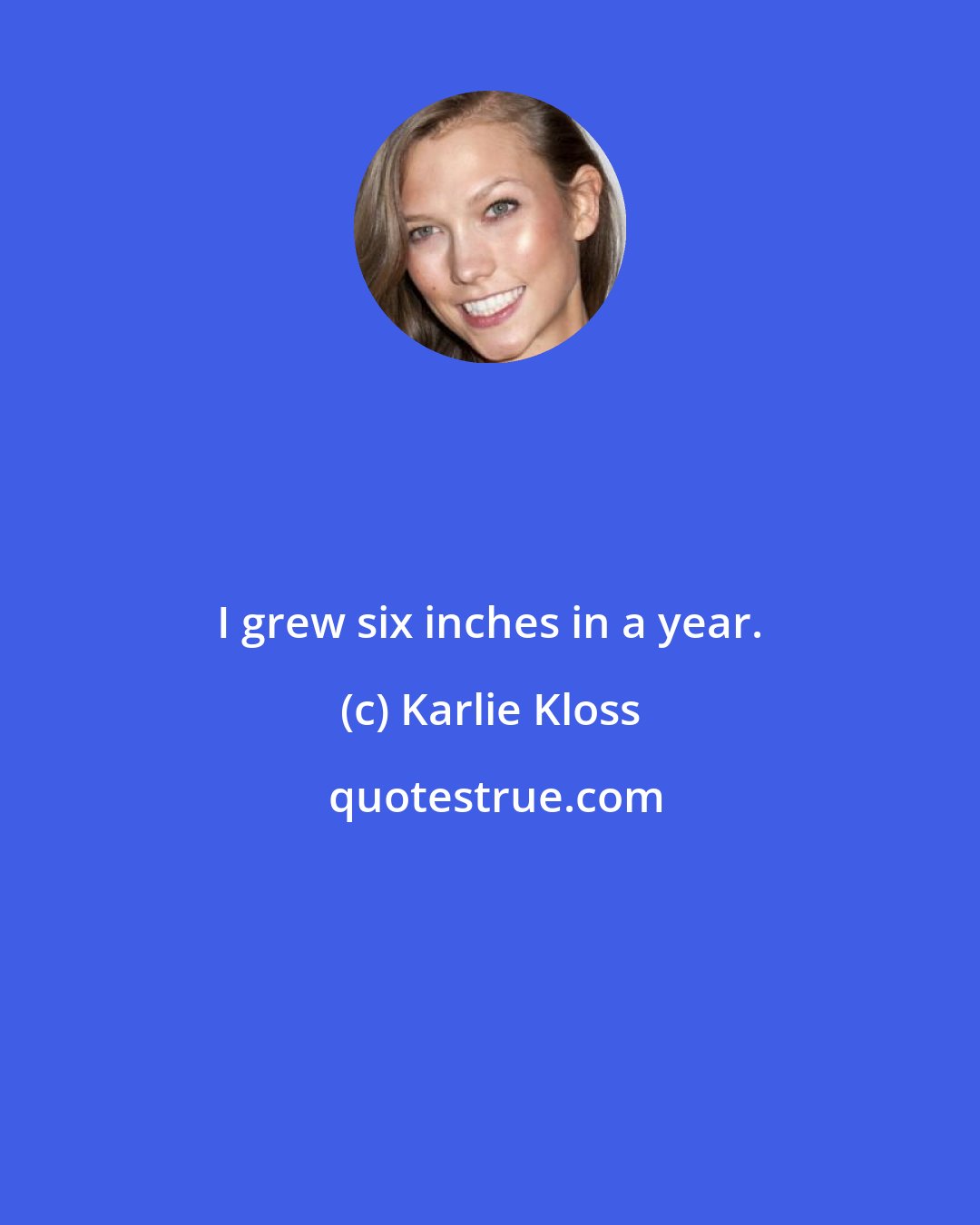 Karlie Kloss: I grew six inches in a year.