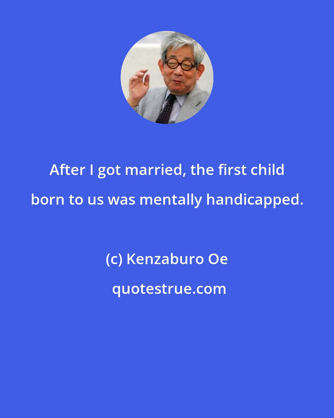 Kenzaburo Oe: After I got married, the first child born to us was mentally handicapped.