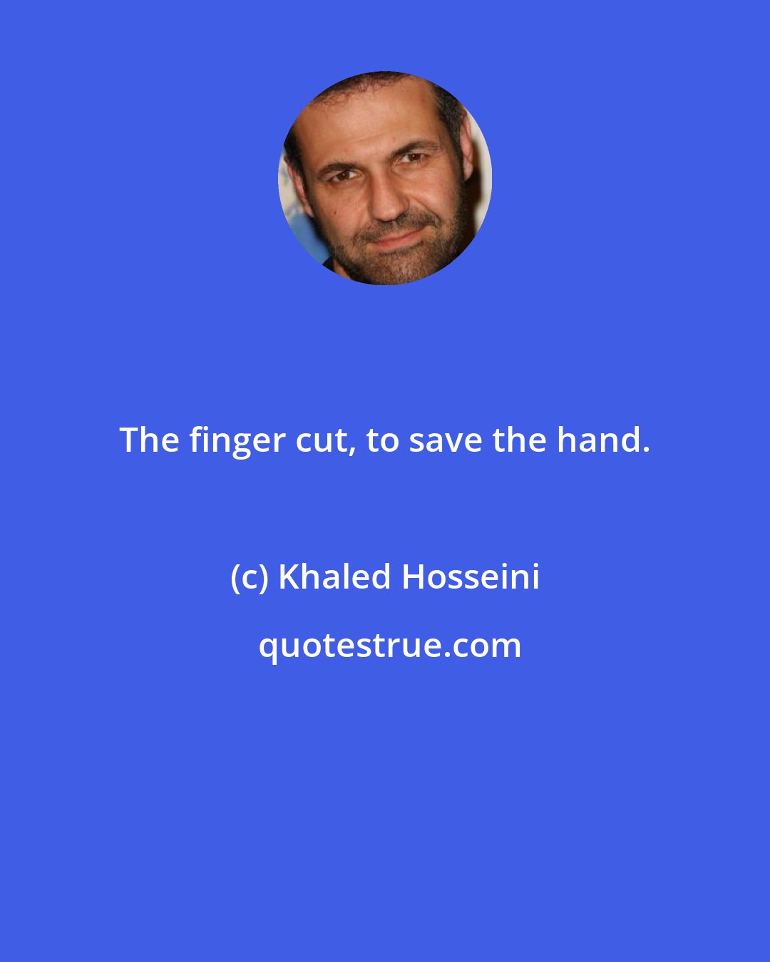 Khaled Hosseini: The finger cut, to save the hand.