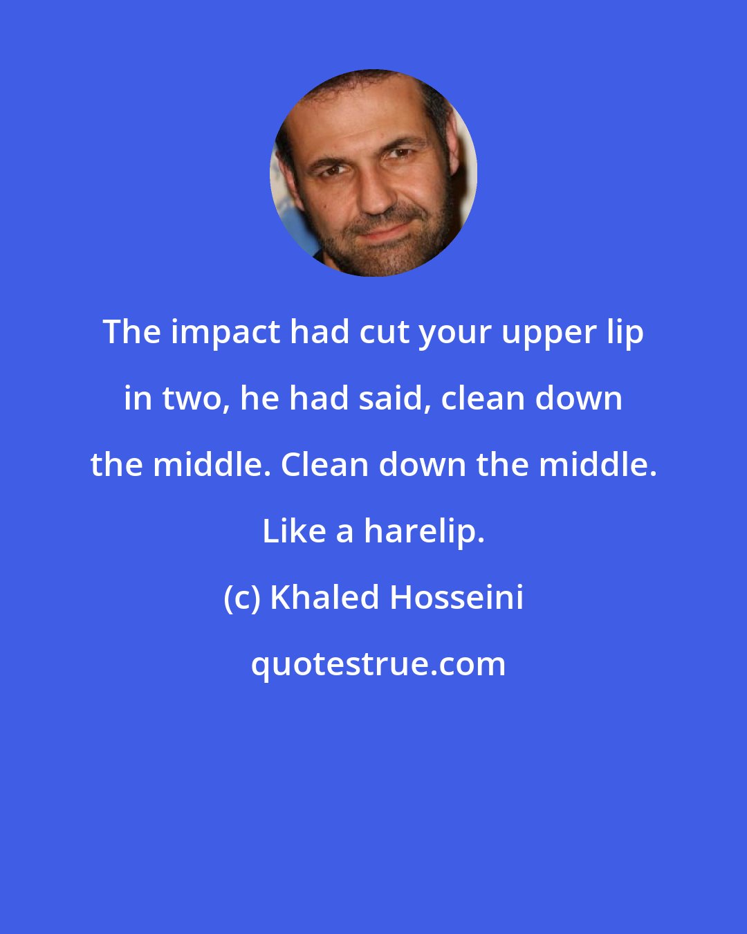 Khaled Hosseini: The impact had cut your upper lip in two, he had said, clean down the middle. Clean down the middle. Like a harelip.