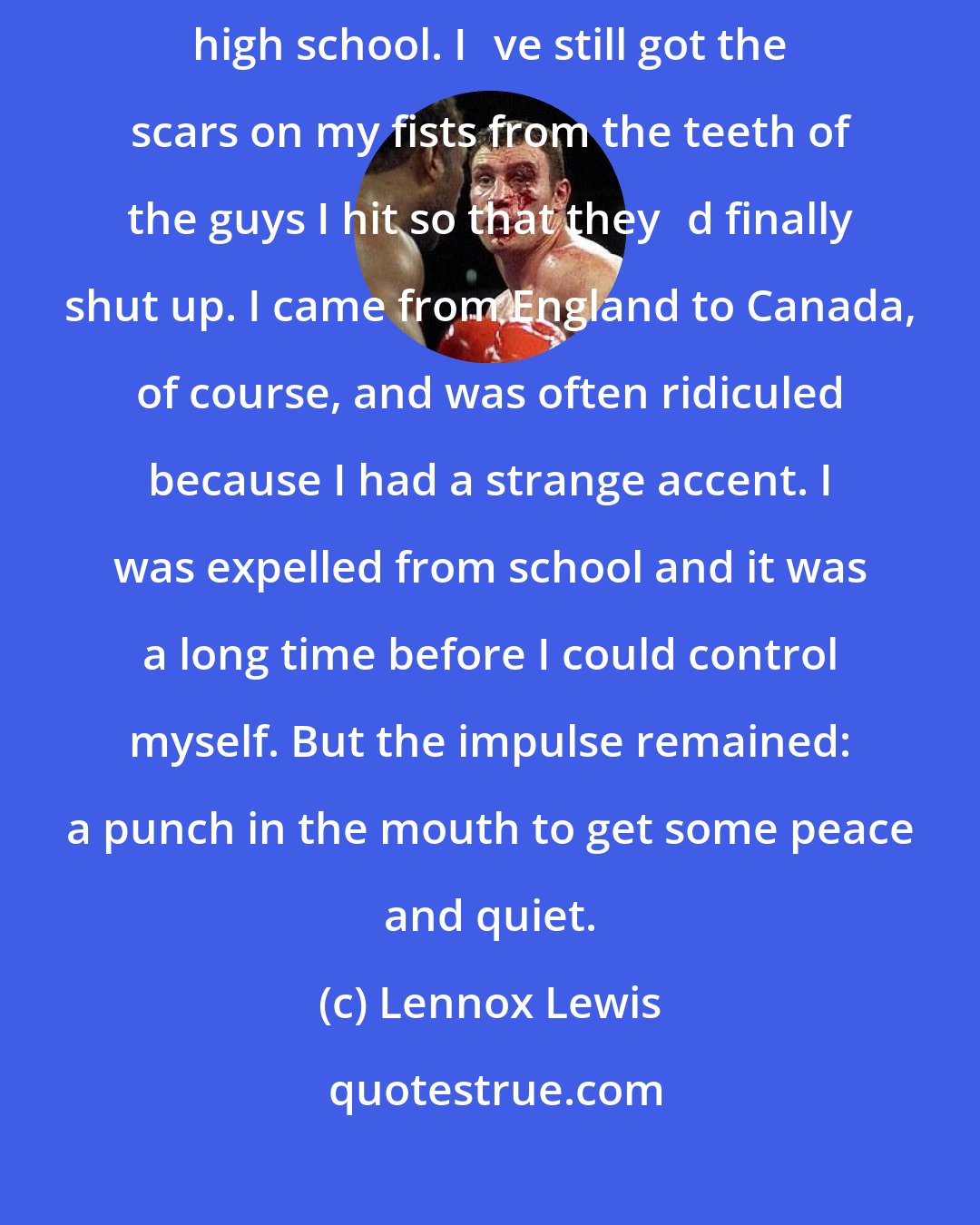 Lennox Lewis: I could never stand big-mouthed types. I had problems with that at high school. Ive still got the scars on my fists from the teeth of the guys I hit so that theyd finally shut up. I came from England to Canada, of course, and was often ridiculed because I had a strange accent. I was expelled from school and it was a long time before I could control myself. But the impulse remained: a punch in the mouth to get some peace and quiet.