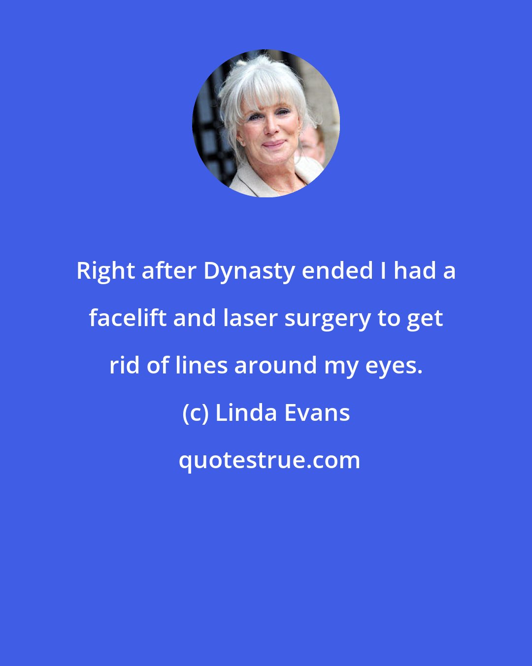 Linda Evans: Right after Dynasty ended I had a facelift and laser surgery to get rid of lines around my eyes.