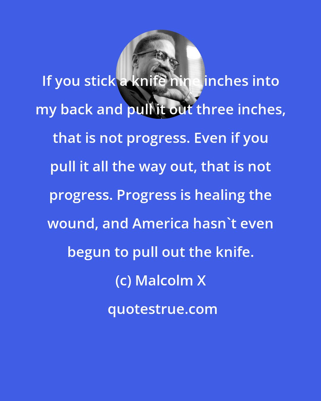 Malcolm X: If you stick a knife nine inches into my back and pull it out three inches, that is not progress. Even if you pull it all the way out, that is not progress. Progress is healing the wound, and America hasn't even begun to pull out the knife.