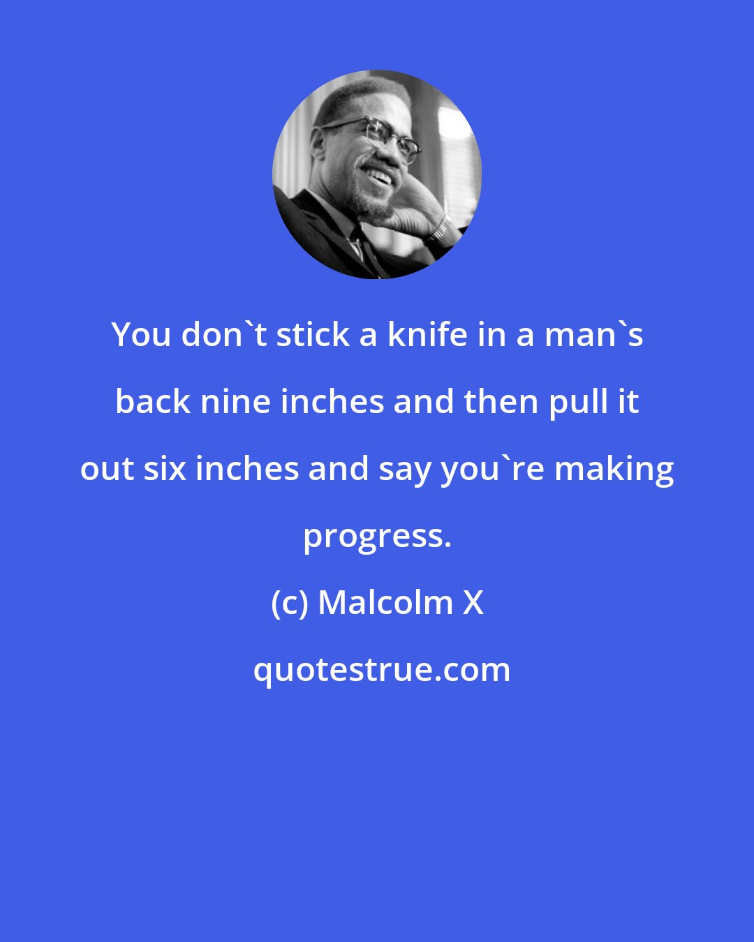 Malcolm X: You don't stick a knife in a man's back nine inches and then pull it out six inches and say you're making progress.