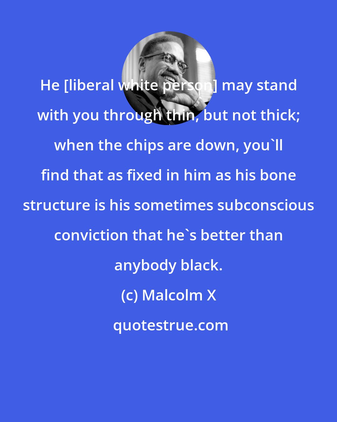 Malcolm X: He [liberal white person] may stand with you through thin, but not thick; when the chips are down, you'll find that as fixed in him as his bone structure is his sometimes subconscious conviction that he's better than anybody black.