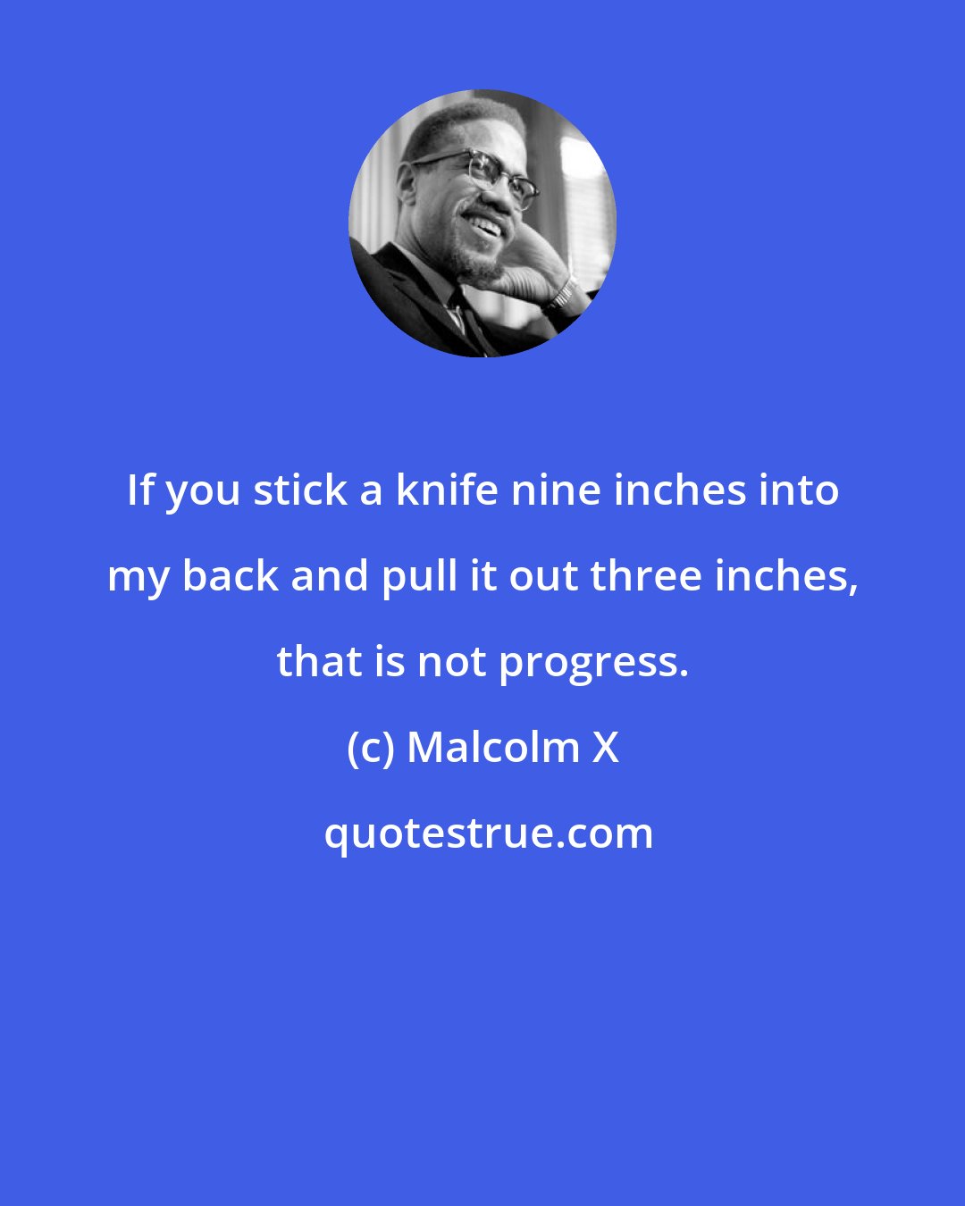 Malcolm X: If you stick a knife nine inches into my back and pull it out three inches, that is not progress.