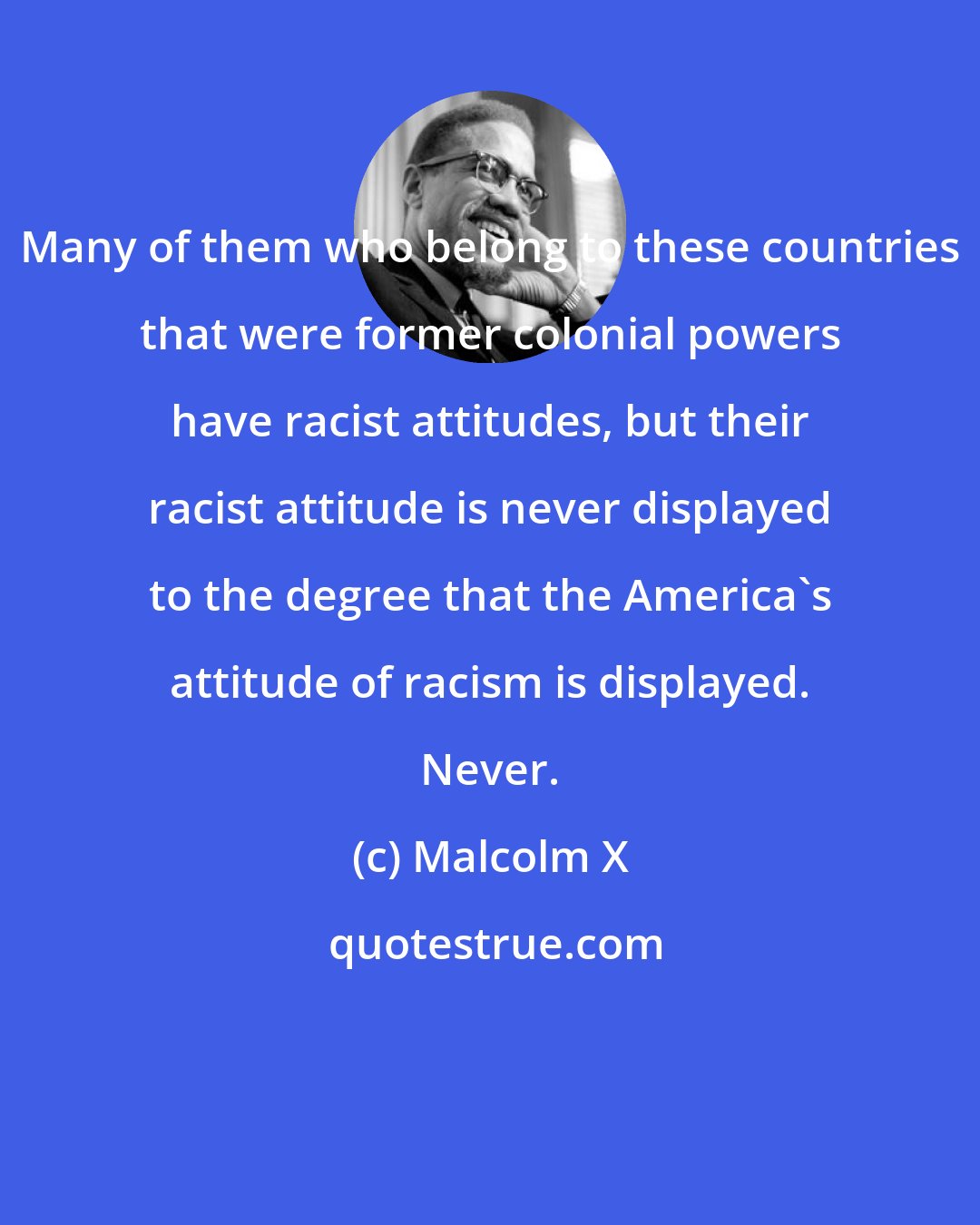 Malcolm X: Many of them who belong to these countries that were former colonial powers have racist attitudes, but their racist attitude is never displayed to the degree that the America's attitude of racism is displayed. Never.