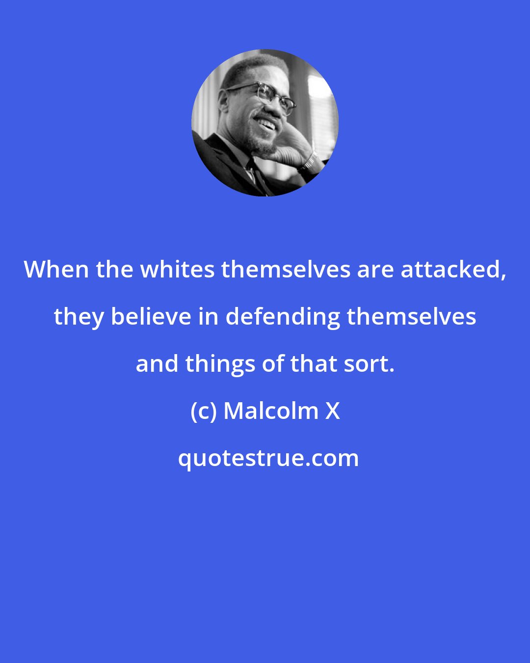 Malcolm X: When the whites themselves are attacked, they believe in defending themselves and things of that sort.