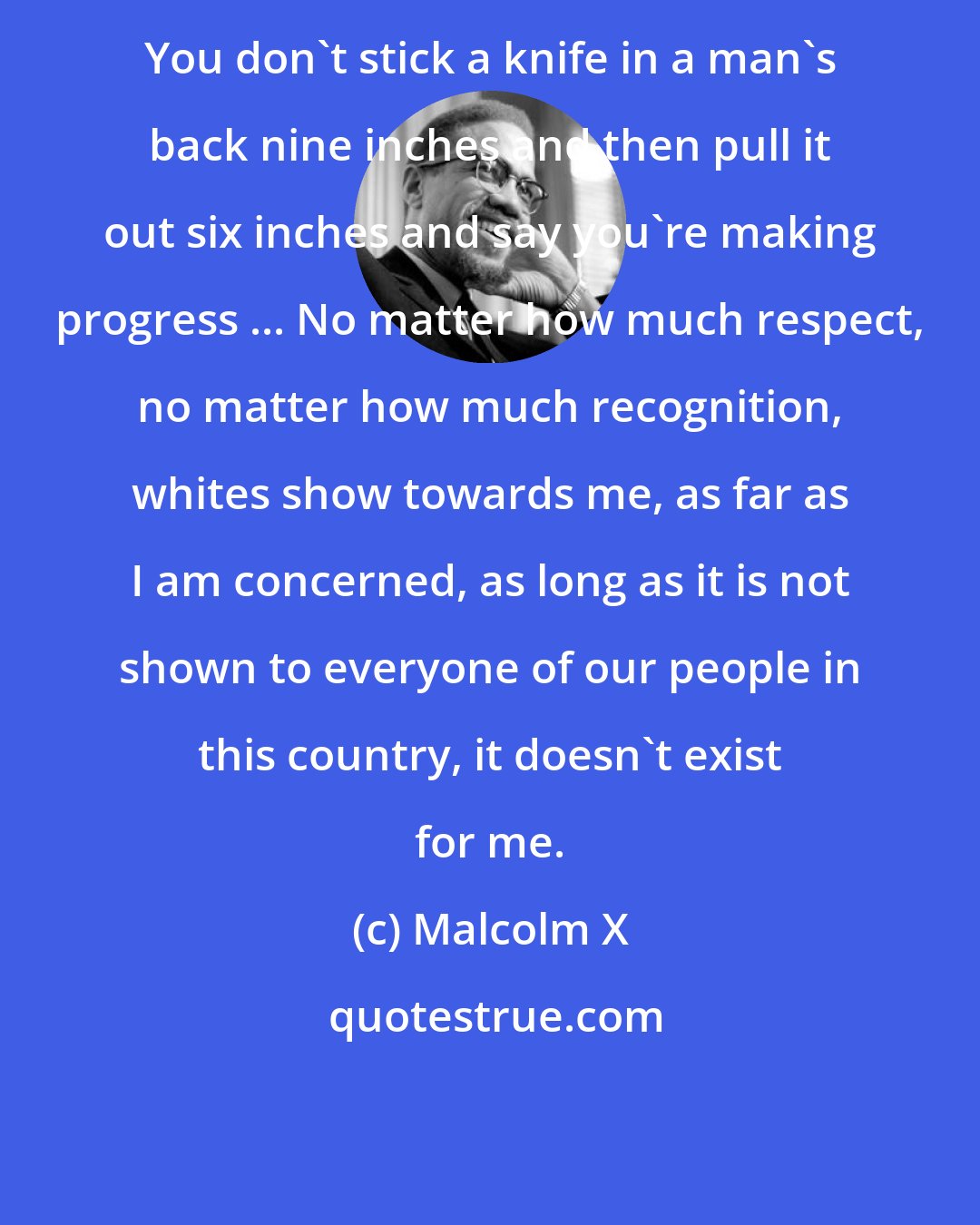 Malcolm X: You don't stick a knife in a man's back nine inches and then pull it out six inches and say you're making progress ... No matter how much respect, no matter how much recognition, whites show towards me, as far as I am concerned, as long as it is not shown to everyone of our people in this country, it doesn't exist for me.