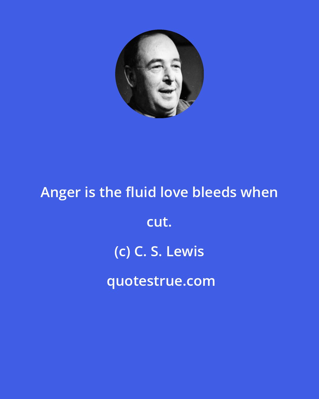 C. S. Lewis: Anger is the fluid love bleeds when cut.