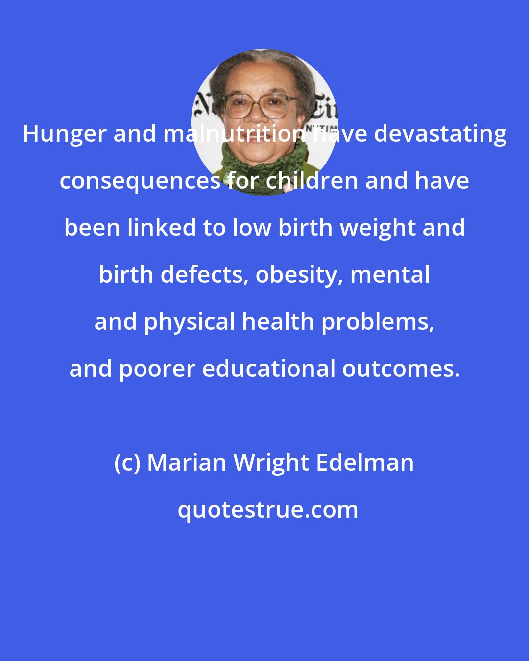 Marian Wright Edelman: Hunger and malnutrition have devastating consequences for children and have been linked to low birth weight and birth defects, obesity, mental and physical health problems, and poorer educational outcomes.
