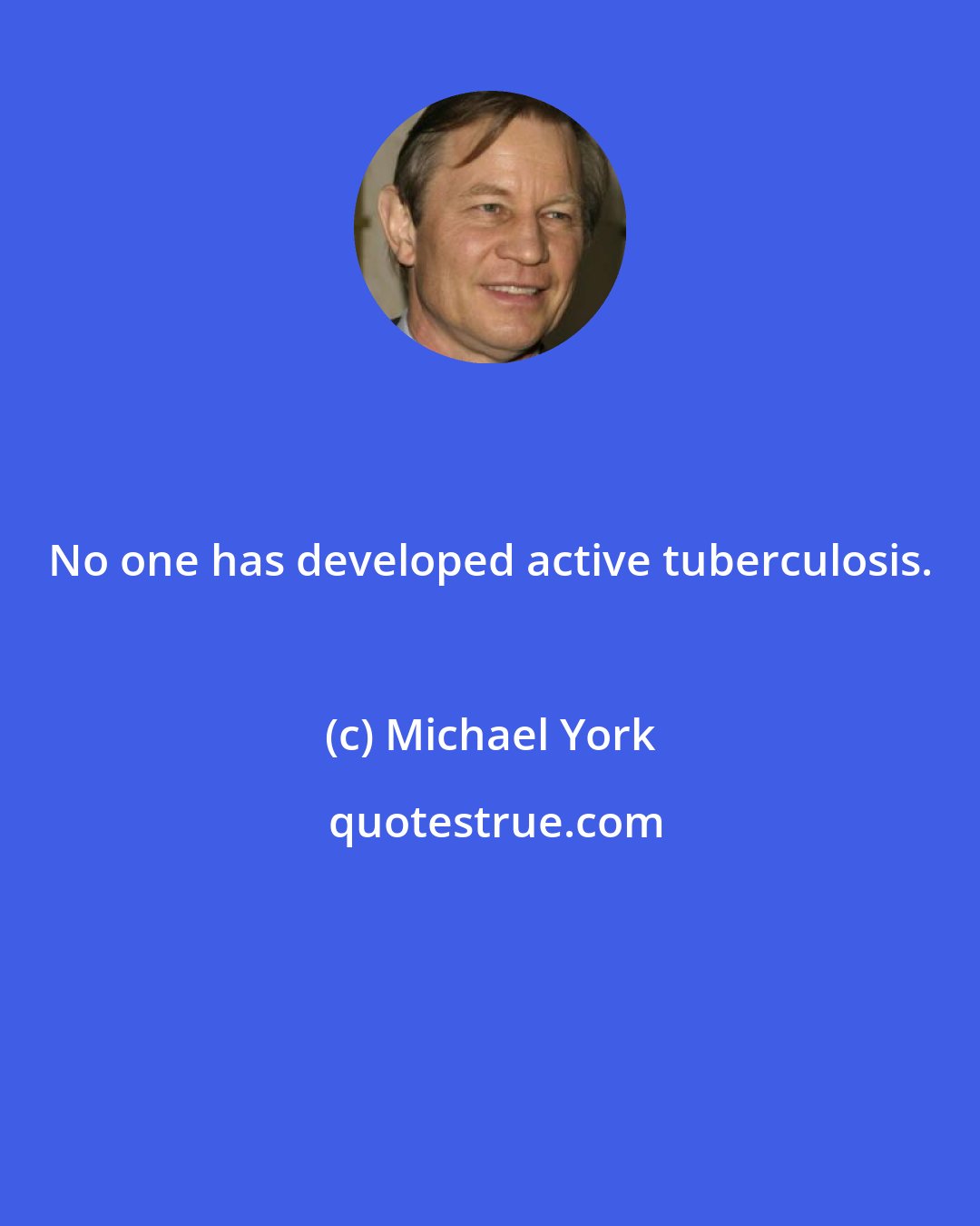 Michael York: No one has developed active tuberculosis.